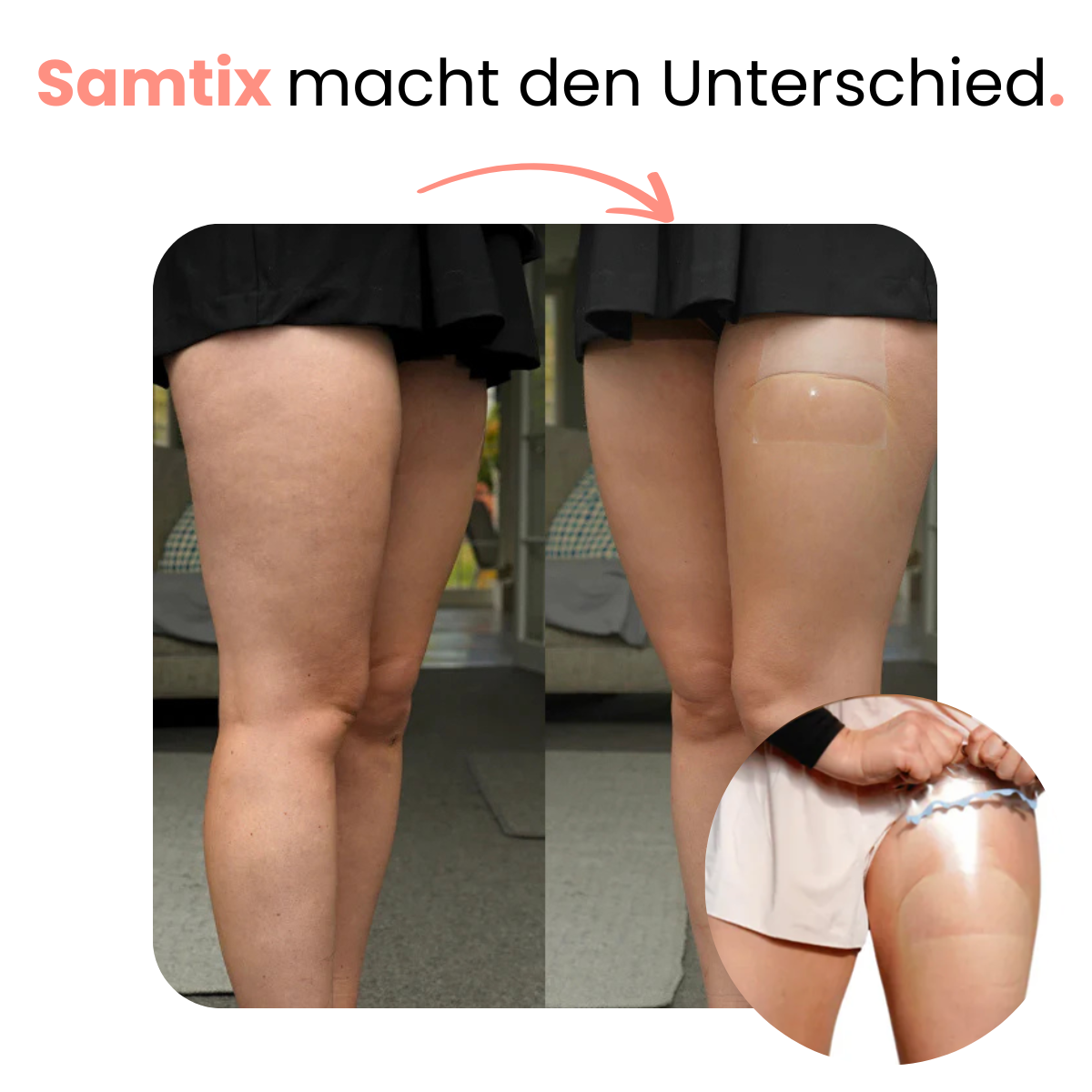 StraffFix Patches